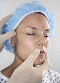 удаление возрастных пятен с помощью химического пилинга удаление возрастных пятен с помощью химического пилинга