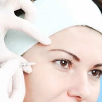 Липофиллинг: безопасная коррекция