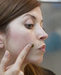 как лечить акне как лечить акне