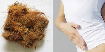 отвары при цистите отвары при цистите