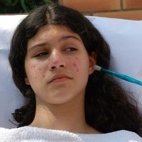 диета при ветрянке у взрослых диета при ветрянке у взрослых