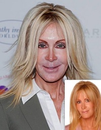 социальные эффекты пластической хирургии социальные эффекты пластической хирургии