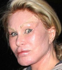 неудачные пластические операции Джоселин Вилденстейн неудачные пластические операции Джоселин Вилденстейн