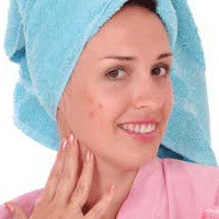 прыщи типы воспаленных угрей прыщи типы воспаленных угрей